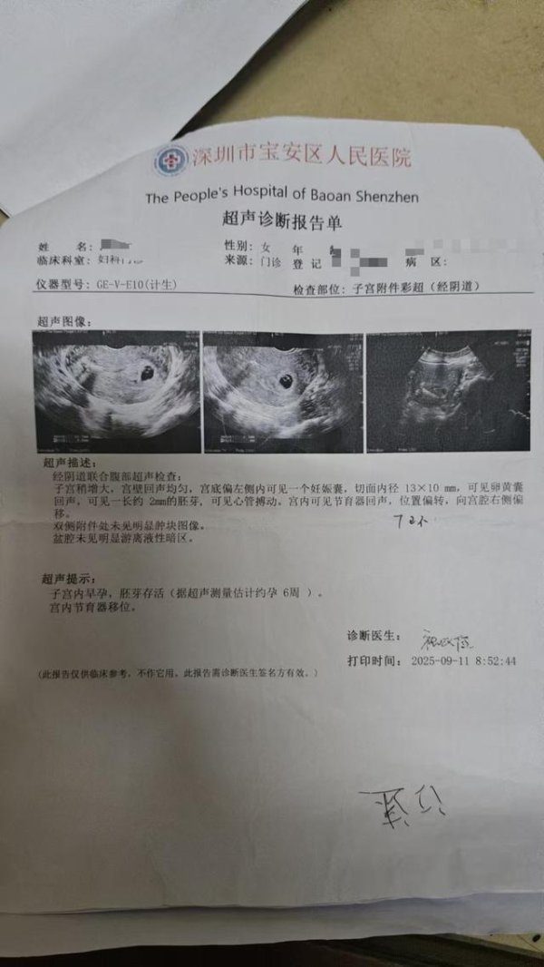 实盘配资一般不超过多少 女子带环怀孕无奈手术，复查时咋还残留胚胎？医院：术前已告知风险